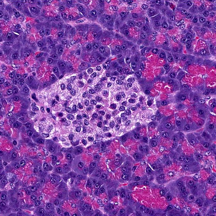 Lichtmikroskopische Sicht in die Bauchspeicheldrüse, violett-pinke Strukturen 